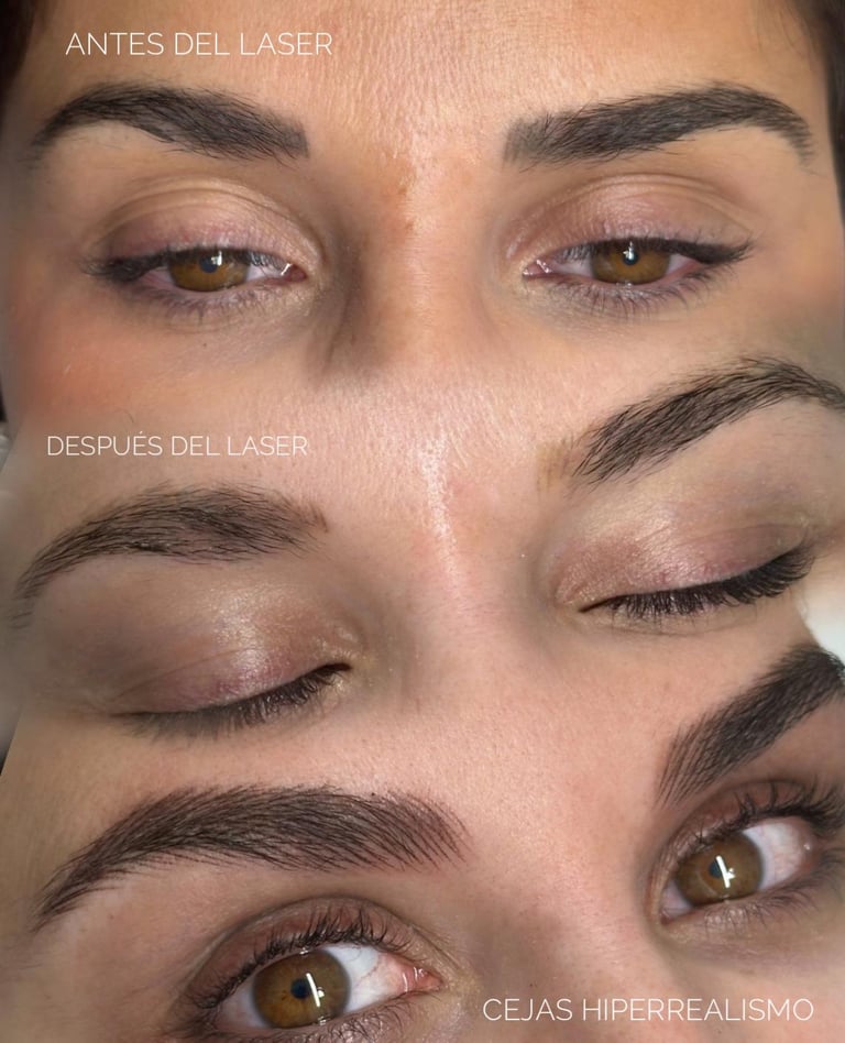 micropigmentacion-cejas-pelo-a-pelo-madrid-marta-hernanz