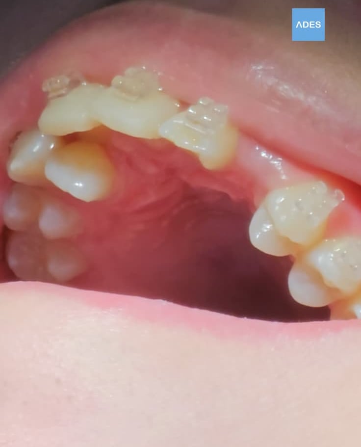 Niños en clínica dental en Badajoz