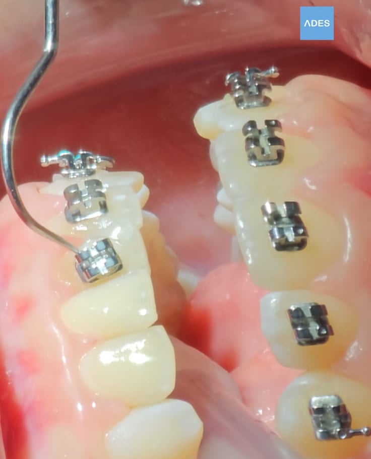 brackets metalicos badajoz