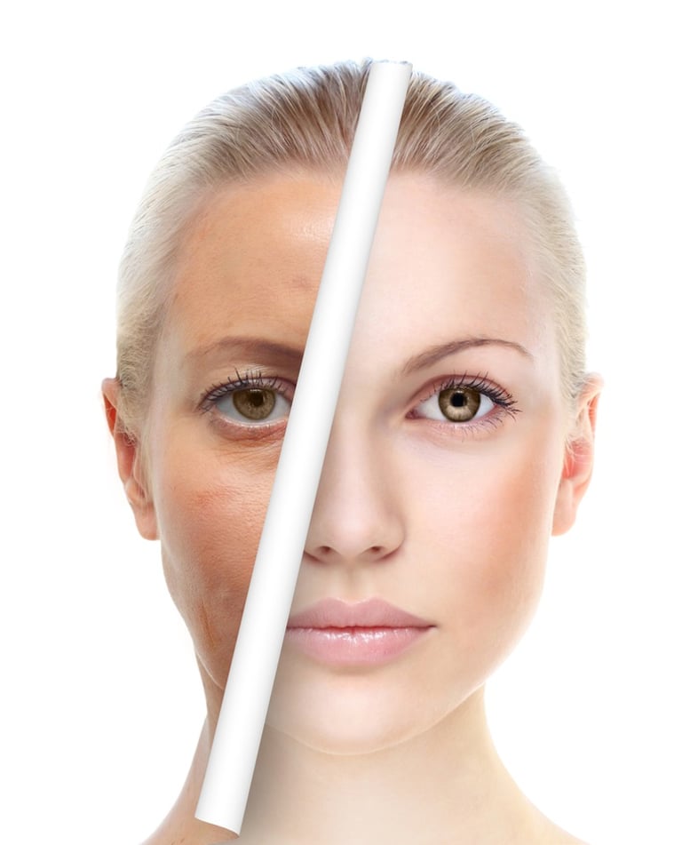 eliminar manchas, paño, melasma