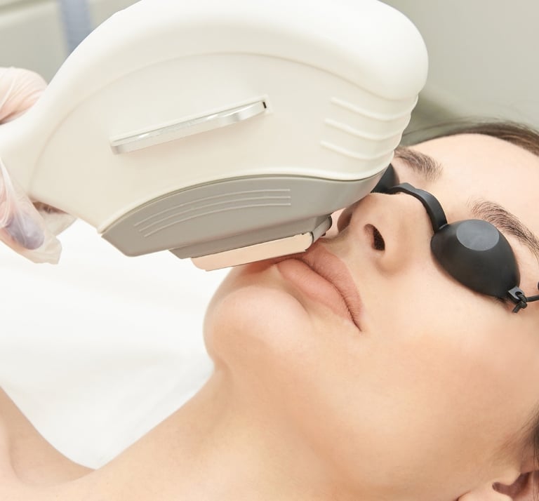 Rejuvenecimiento facial
