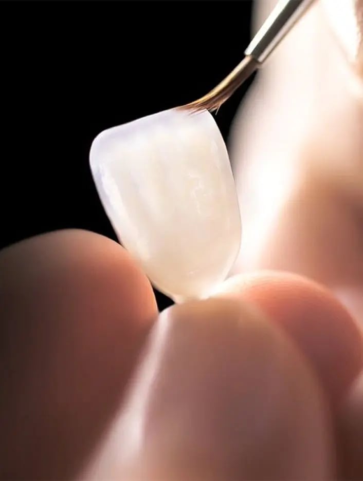 Dentista aplicando lentes de contato dental em paciente, utilizando tecnologia moderna em clínica de Taguatinga.