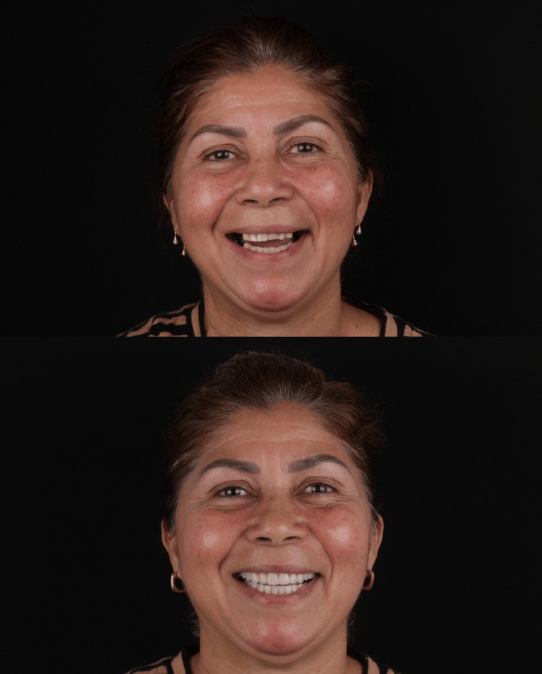 RECORTAR FUNDO DESTA IMAGEM 