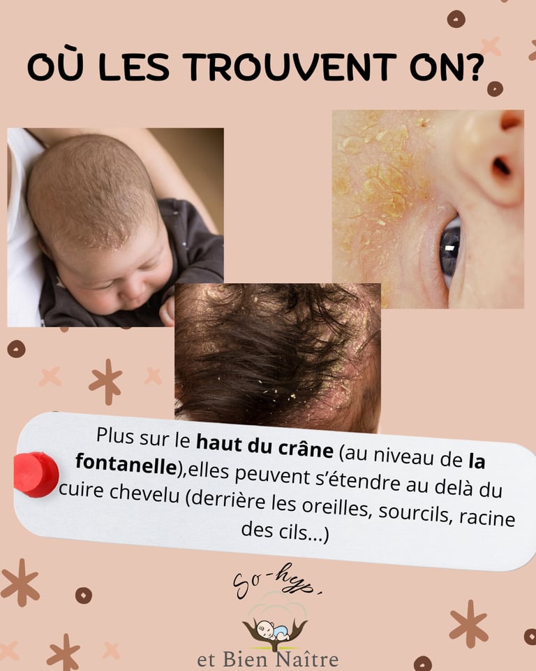 soin nouveau né loire