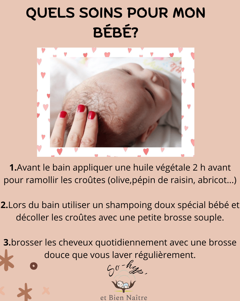 soin bébé croûtes de lait