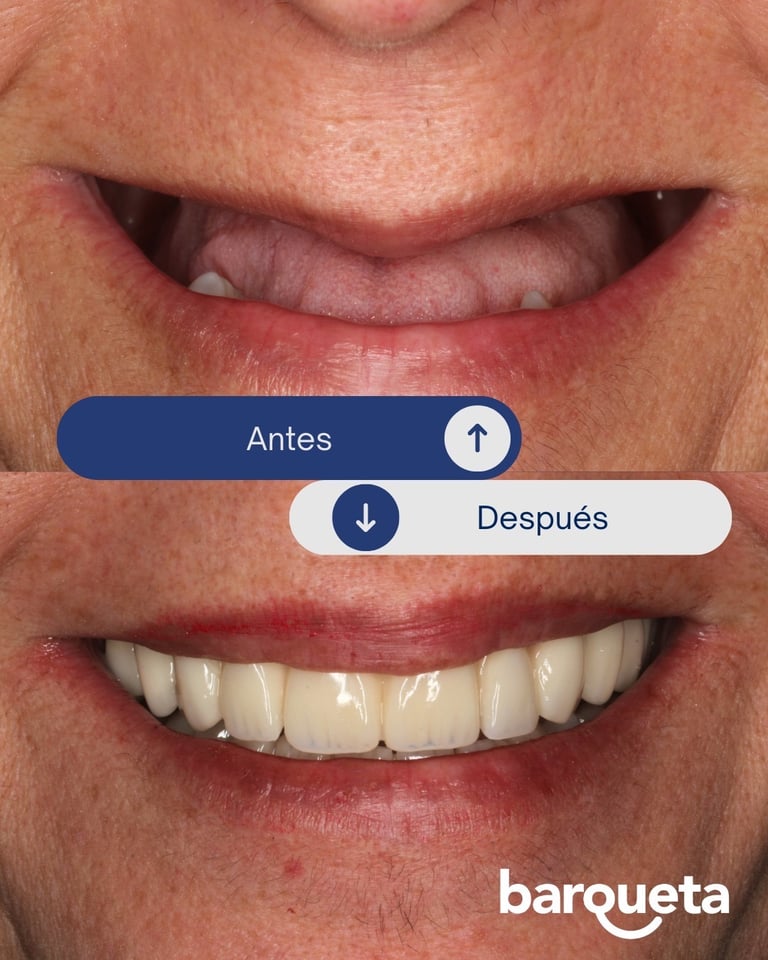 Paciente satisfecho tras un tratamiento de implantes dentales en nuetsra clínica dental de sevilla