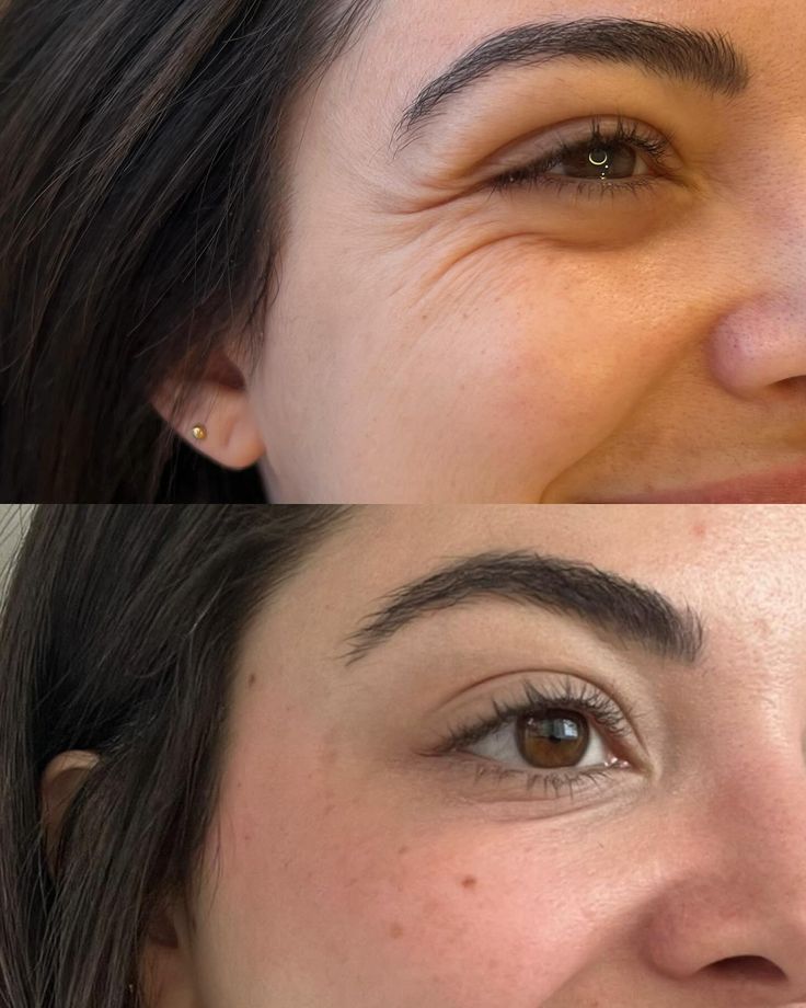 Botoks Grodzisk Mazowiecki