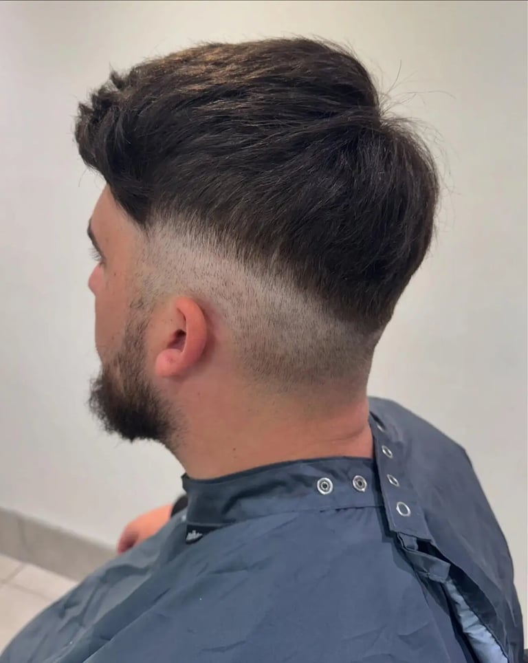 male hair loss clinic Hull  