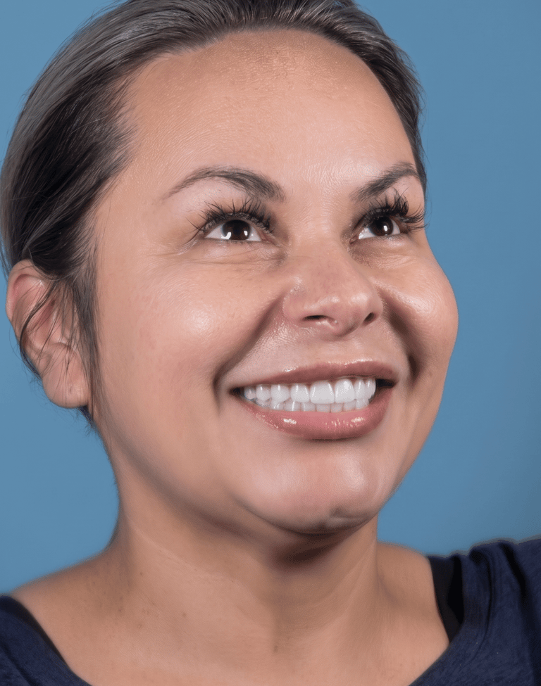 Implantes dentales con resultado natural, función y confianza diseñada para durar.
