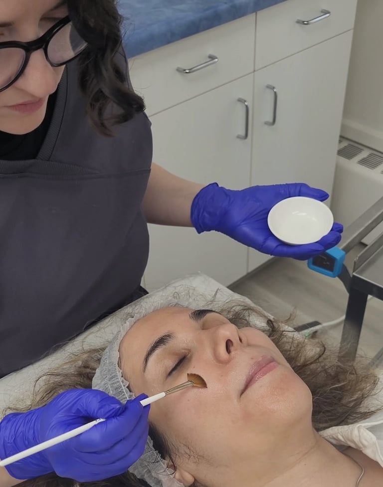 A rejuvenating chemical peel performed on a young client at Ariana Esthetic, Edmonton.