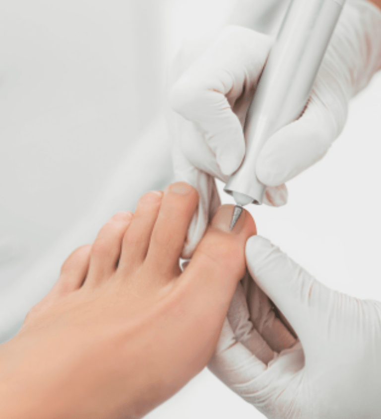 Professionele voetverzorging met een medisch instrument uitgevoerd door een pedicure.