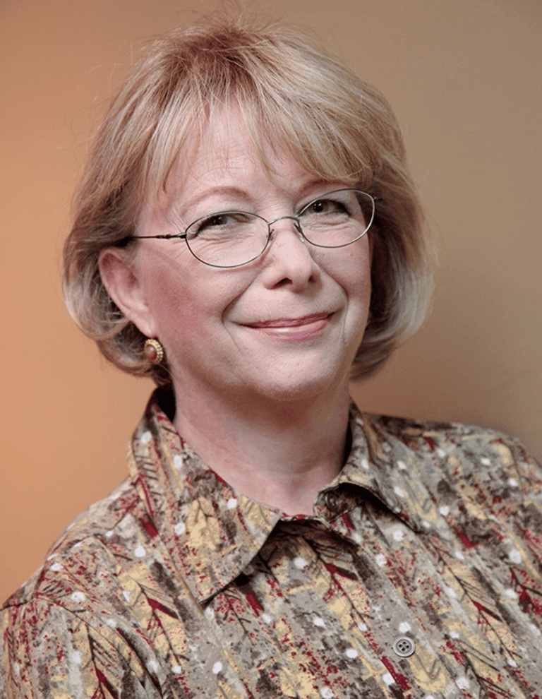 Before permanent non-surgical hair replacement – overall thinning hair showing scalp through the par