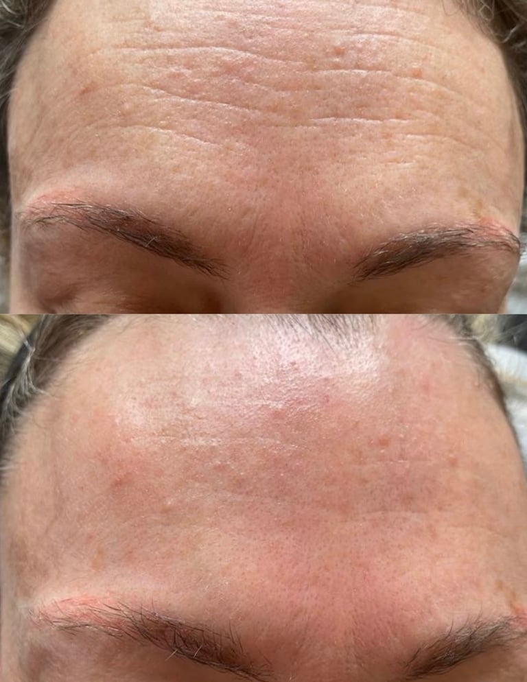 séances Young Face  - Cabinet Harmonie Plantaire