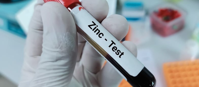 Serum çinko testi, vücuttaki çinko seviyelerini ölçerek bağışıklık, saç sağlığı ve metabolizma için kritik bir mineralin duru