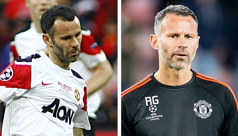 Ryan Giggs hair transplant