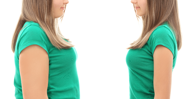 Weight Loss