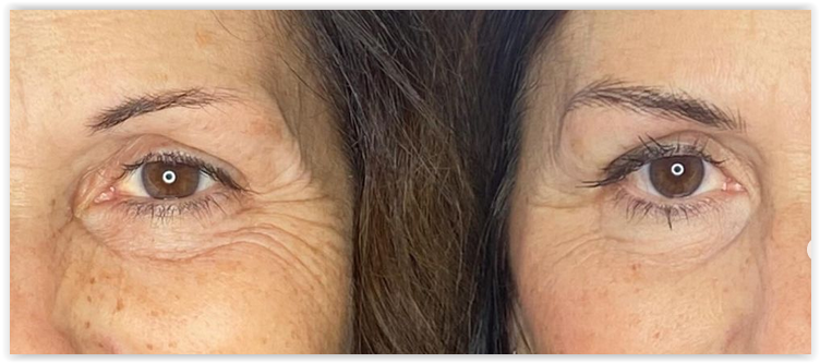 Trucco semipermanente sopracciglia Pelo realistioco. Confronto prima e dopo.
