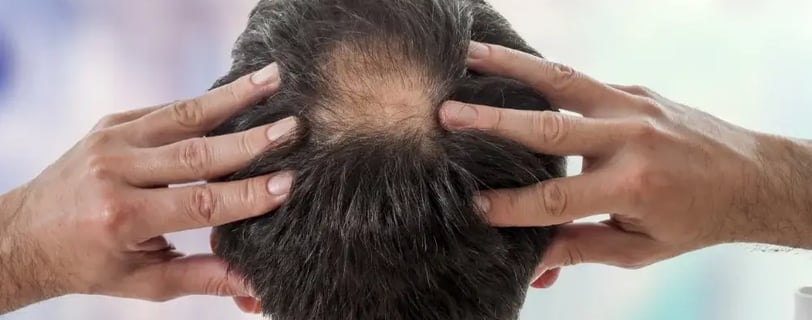 How Does Caffeine Shampoo Combat Hair Loss?