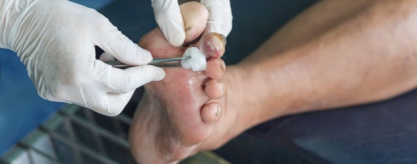 diabetic sores on feet
