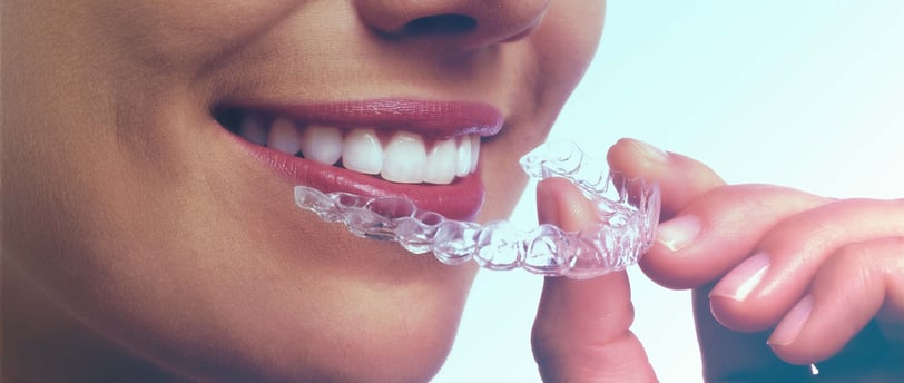 aparat dentar pret