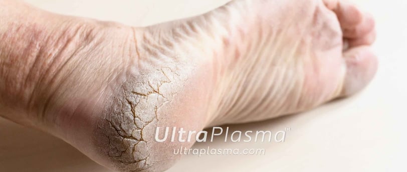 ultra_plasma_ultra_plazma_ultra-plasma_ultra-plazma