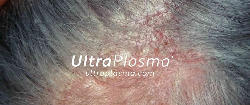 _ultra_plasma_ultra_plazma_ultra-plasma_ultra-plazma