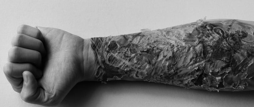 a scabbing tattoo man's arm with a tattoo on it