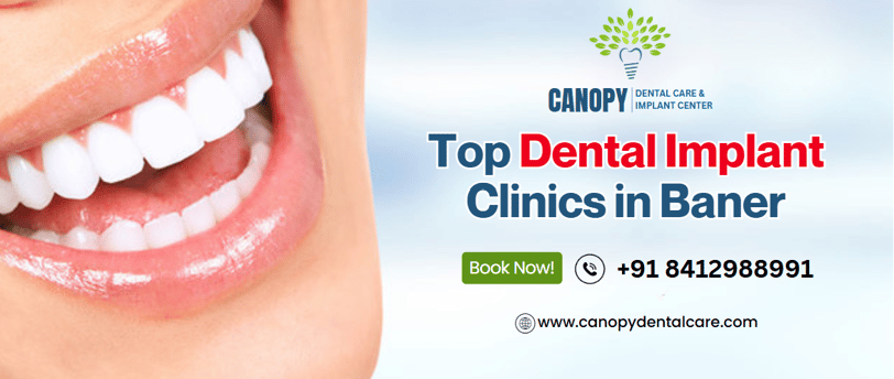 top dental implant in baner