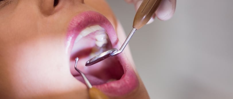 Limpeza dental completa