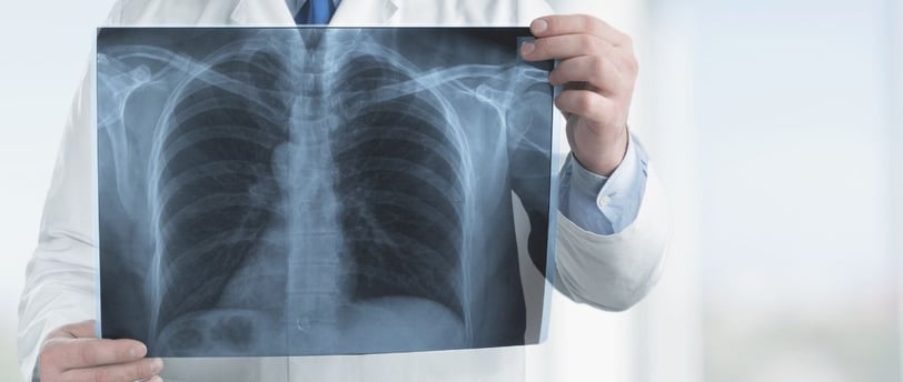 radiografia pulmones