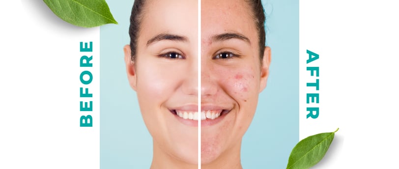 Allors Skin Care Before and After Blog Post feature image of a woman with results after using Allors Products