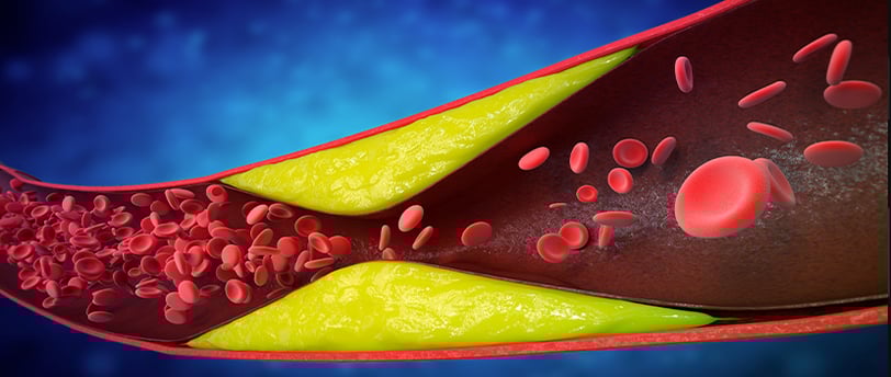 Como os níveis de triglicerídeos afetam a saúde cardiovascular?