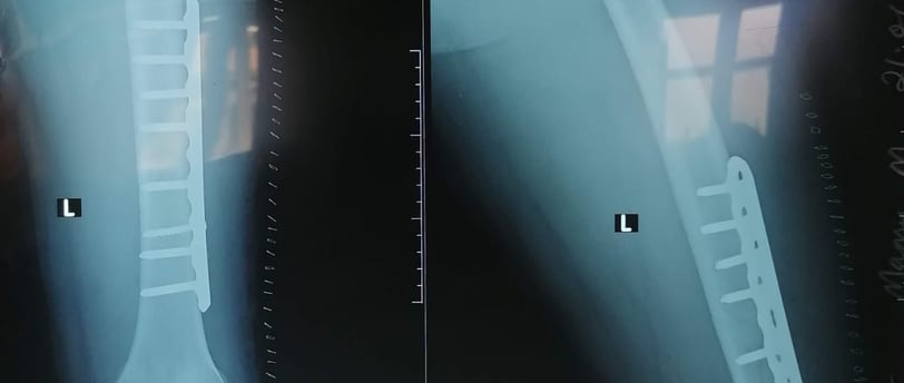 a pair of two pictures of a broken leg