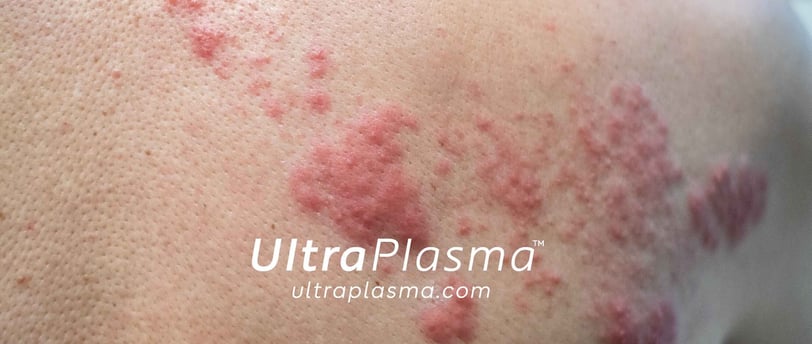 _ultra_plasma_ultra_plazma