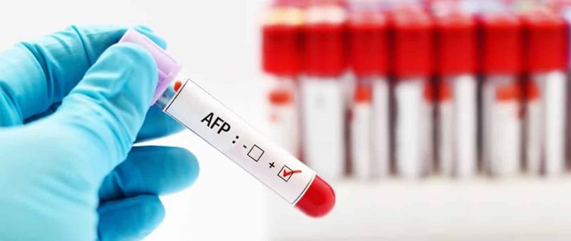 Alfa-fetoprotein (AFP) testi, karaciğer kanseri ve bazı diğer kanser türlerinin teşhis testidir.