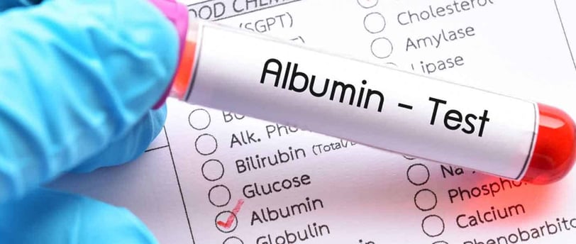 Albumin Testi Nedir? Karaciğer ve Böbrek Sağlığı İçin Önemi