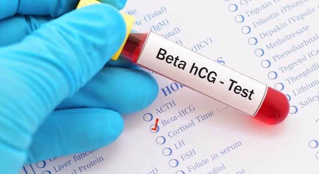 HCG Beta Nedir? Hamilelik Testlerinde Önemi