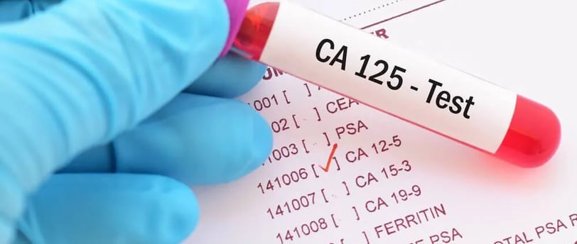 CA 125 testi, yumurtalık kanseri riskini değerlendirmek için kullanılan bir tümör belirteç testidir.