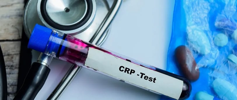 CRP Testi Nedir? Vücutta Enfeksiyon Belirtileri ve Sonuçlar