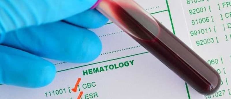 ESR testi, vücutta iltihap ve enfeksiyon olup olmadığını belirlemek için kullanılan önemli bir kan testidir.