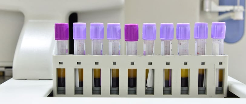 Tam Kan Sayımı (Hemogram) Test Sonuçlarını Doğru Okuma ve Yanlış Sonuçlara Dikkat!