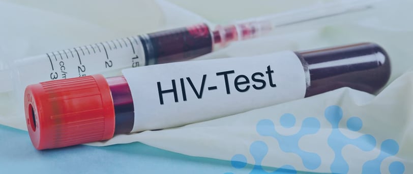 HIV Testi Nasıl Yapılır? Güvenilirliği ve Sonuçları
