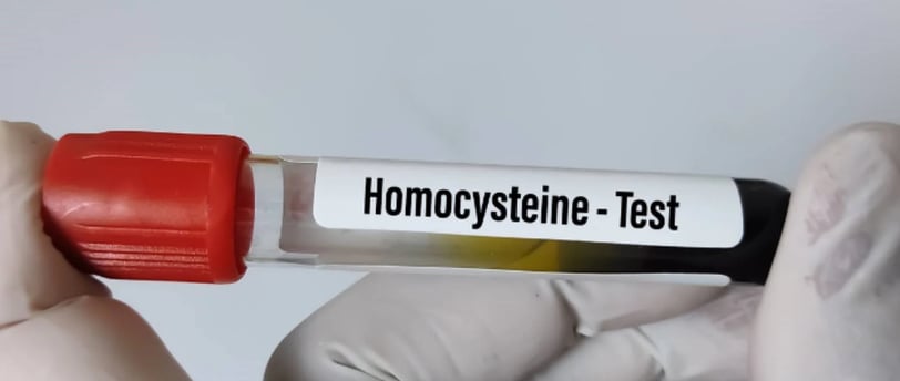 Homokistein testi, kalp ve damar sağlığını değerlendirmek için yapılan önemli bir kan testidir.
