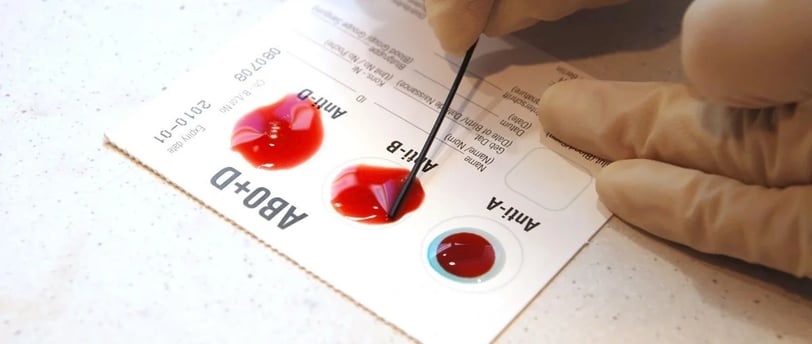 Kan Grubu Testi Nasıl Yapılır? Hangi Bilgileri Verir?