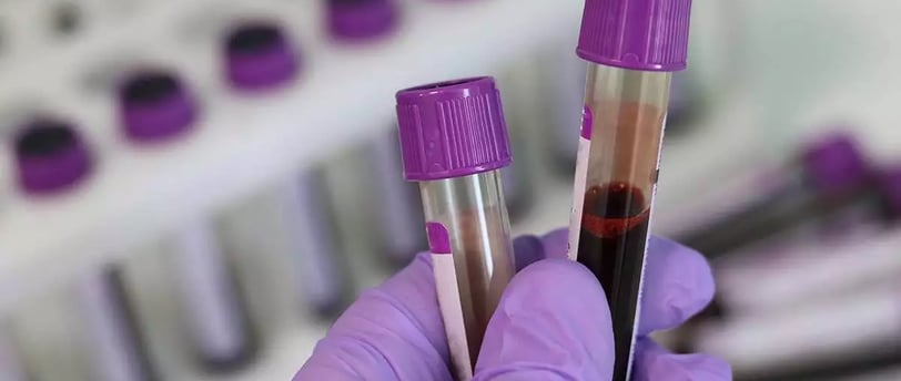Kanser Taramaları: Hangi Testler Erken Tanıda Önemlidir?