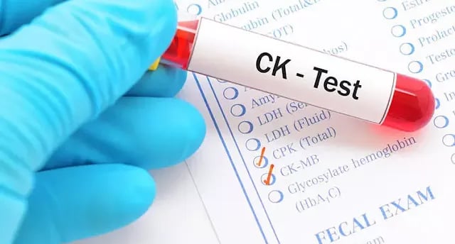 Kreatin kinaz (CK) testi, kas hasarı ve kas hastalıklarının teşhisinde kullanılan önemli bir kan testidir.