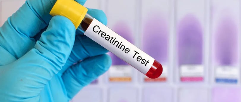 Kreatinin klerens testi, böbreklerin atık maddeleri ne kadar iyi filtrelediğini ölçen önemli bir testtir.