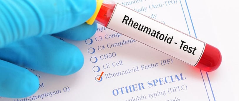 Romatoid Faktör (RF) Testi Nedir? Romatizma ve Tanı Yöntemleri