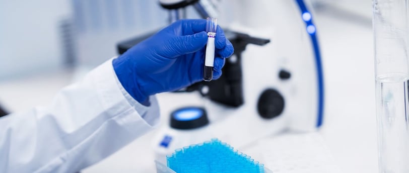 Serum fosfor testi, vücutta fosfor seviyesini ölçerek kemik ve kas sağlığının değerlendirilmesini sağlayan önemli bir testtir