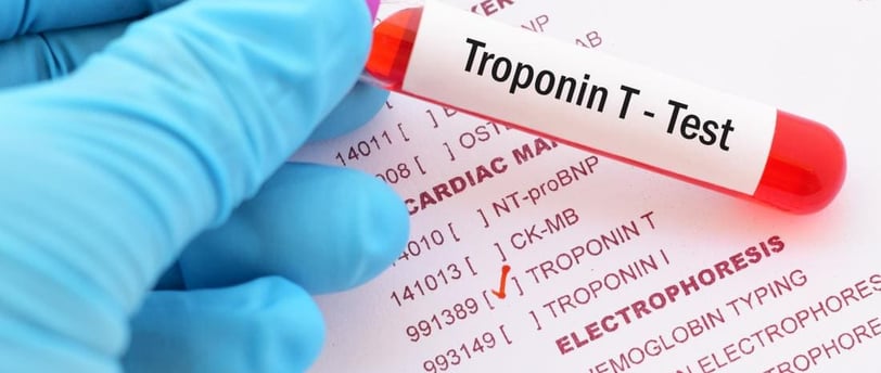 Troponin testi, kalp krizi ve kalp hastalıklarının teşhisinde kullanılan önemli bir kan testidir.